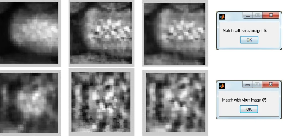 Figure 4 : (a) Input Image; (b) Contrasted Limited Adaptive Histogram Equalization; (c) Adaptive Weiner Filtering; (d) Classification Output 