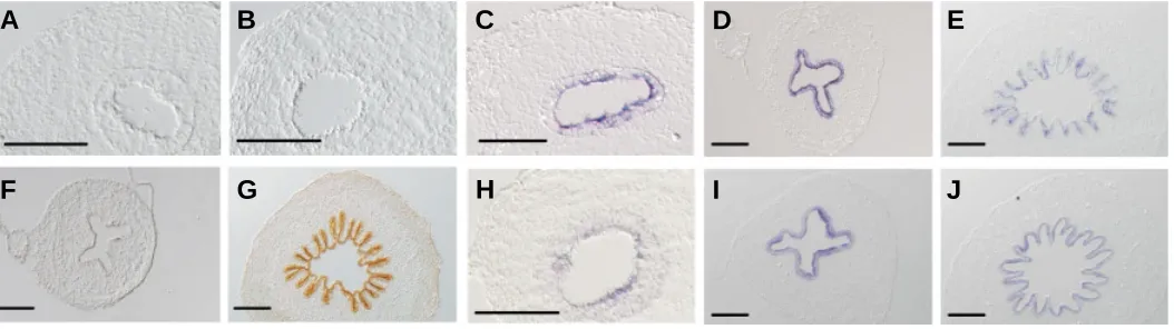 Fig. 1. Expression patterns of cIFABP (A-E), sucrase (F,G) and CdxA (H-J) in the small intestine (A-J), of 5 (A), 6 (B,H), 7 (C), 9(D,F) and 12 (E,G,J)day embryos analyzed in transverse sections by in situ hybridization (cIFABP and CdxA) or immunohistochem