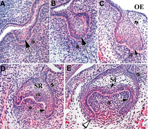 Fig. 2. (Left) Developmental expression of Smad5 during tooth mor-