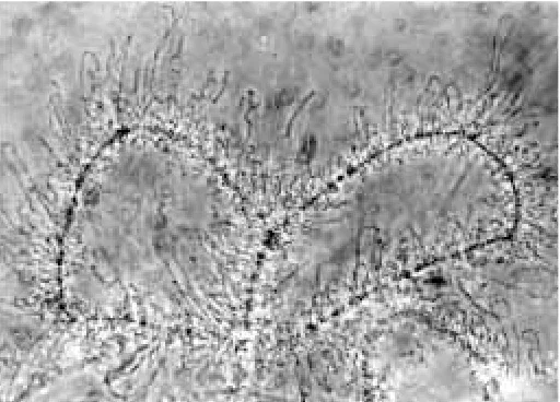 Fig. 2. Example of a lampbrush chromosome preparation prepared by Germinal vesicles were isolated from newts,chromosomes