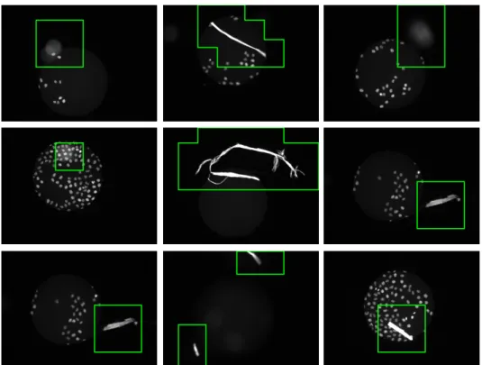 Figure 2.8: Examples of regional defects found by our framework. Regional defects have high variability in scale and appearance however our framework shows a good detection accuracy.