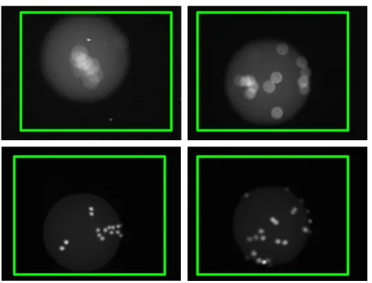 Figure 2.9: Examples of global defects (out-of-focus) found by our framework. The strength of the parameters ν and λ EMD control the amount of blur which is tolerated by the algorithm