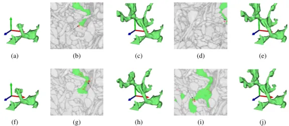 Figure 2.2: User guidance example for two of the proposed estimators. The top row displays the stochastic watershed using the stochastic segmentation instabiltiy estimator (Algorithm 2.3.5.1) , the bottom row the stochastic link instability estimator (Sect