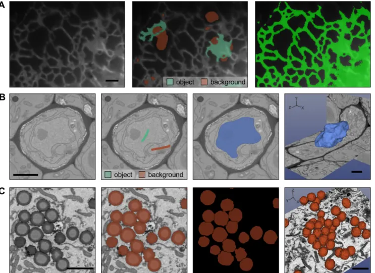 Fig 3. Semiautomatic image segmentation in MIB can dramatically decrease the time spent on modelling
