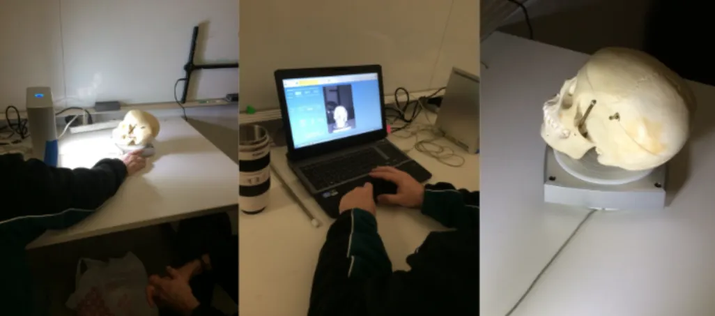 Figure 6.2: Scanning a Real Skull