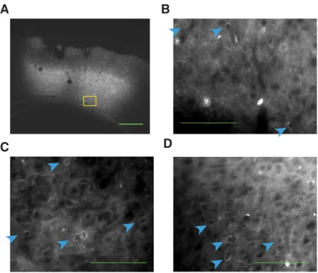 Figure 2. Robust expression of GFP-tagged ChR2 in PPC. A, Brain section from Rat 3 showing injection site within PPC
