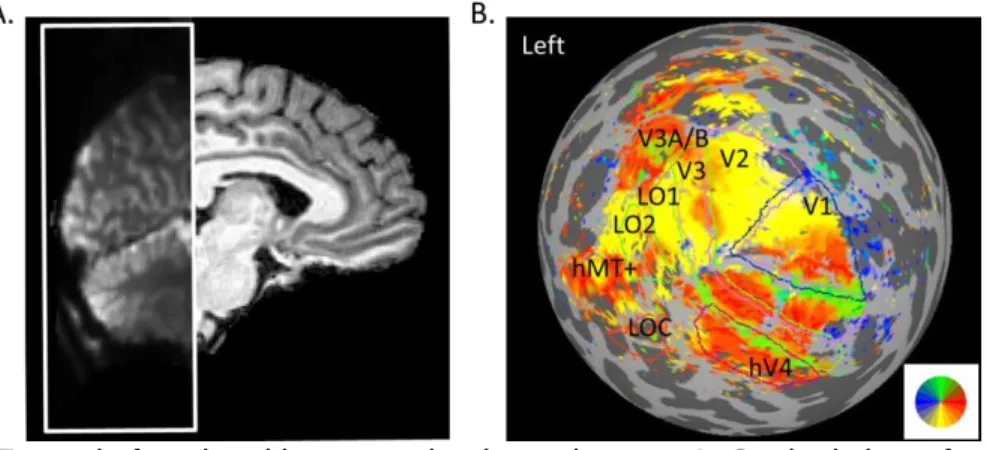 Figure 2.2. Example functional image and retinotopic map. A. Sagittal view of example  functional image coverage