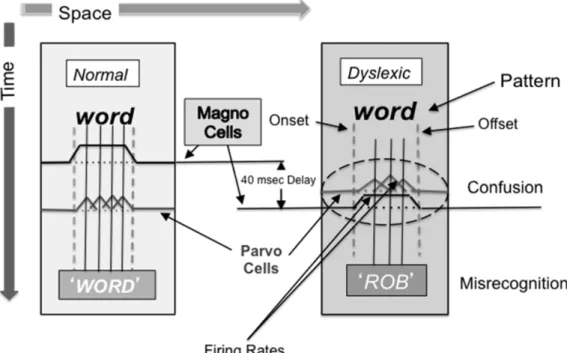 Figure 9. Disrupted magnocellular processing  Reproduced from Lawton (2016), permitted under   the Creative Commons Attribution License (CC BY)