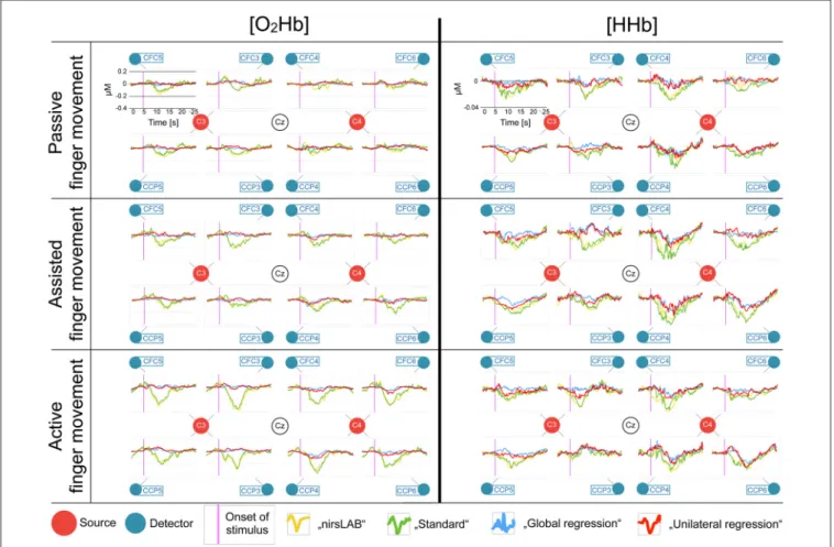 FIGURE 4 | Block averages of each channel, separately for [O 2 Hb] and [HHb]. All eight recorded channels of the motor cortex are displayed in a top-view topographical organization around the left (C3) and the right motor cortex (C4)