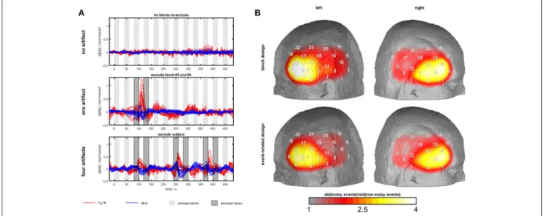 FIGURE 3 | Temporal muscle artifacts for experiment 3. (A) Exemplary fNIRS data with no, one and four artifacts resulting in the exclusion of none, two and seven blocks, respectively, from data analysis