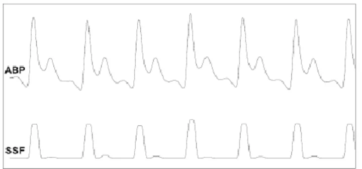 Figure 8. Slope sum function [30] 