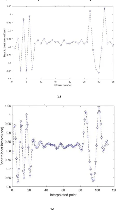Figure 25. Heart beat intervals based on applied interpolation with 4 Hz for the epoch shown in  Figure 19