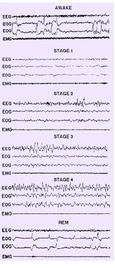 Figure 2-5: EEG, EOG and EMG measures of waves of the brain nerves. 
