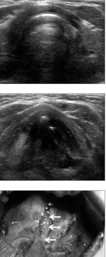 Table 1. Diagnostic Indices for Sonographic Diagnosis of Thyroid Pyramidal Lobes
