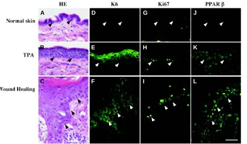 Fig. 5. Immunodetection of PPARβstimuli, e.g. after TPA topical application (TPA) or at the edges of a skin wound (Wound Healing, day three after an injury)