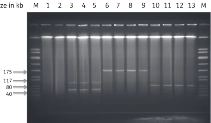 Figure 4. S1 nuclease-digested plasmid DNA extracted from E. faecium strains. Lane M, size marker (SmaI-digested S
