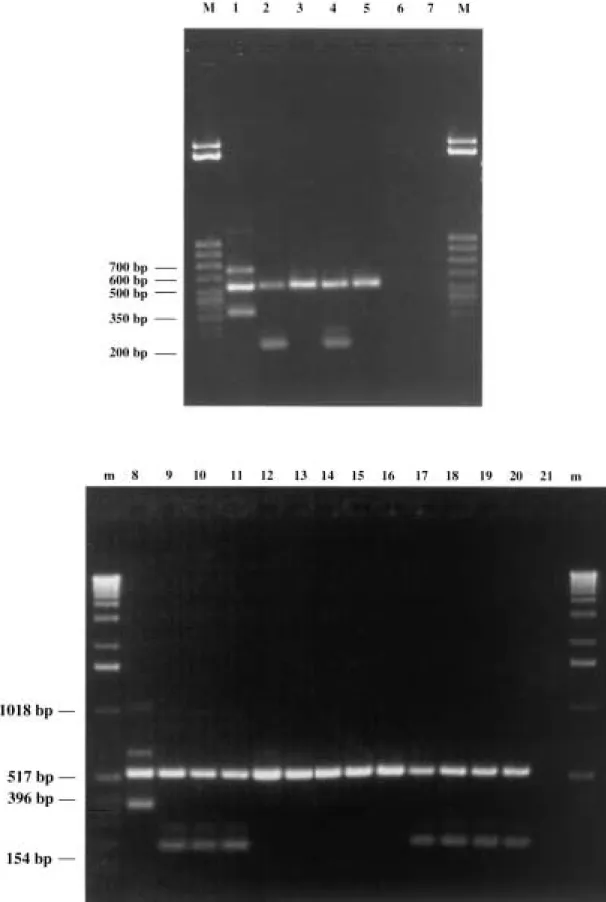 FIG. 6. Ampliﬁcation products obtained from the tuf multiplex assay. Lane M, 50-bp DNA molecular marker (Sigma); lane m, 1-kb DNA ladder (Gibco BRL)