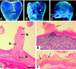 Fig. 4 D,H).Finally, we examined expression of Fgfr2, a genethat is also expressed at high levels in membranous