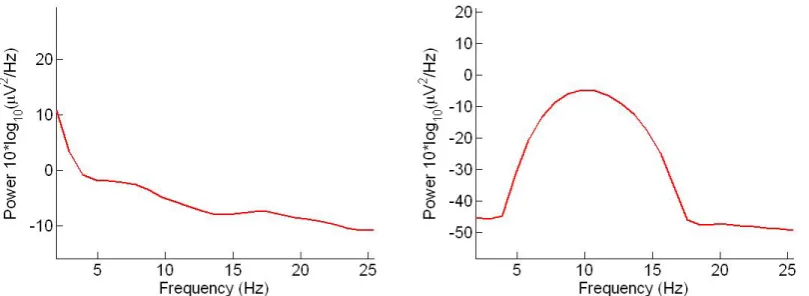 Figure 7 - Schematic of a BCI system