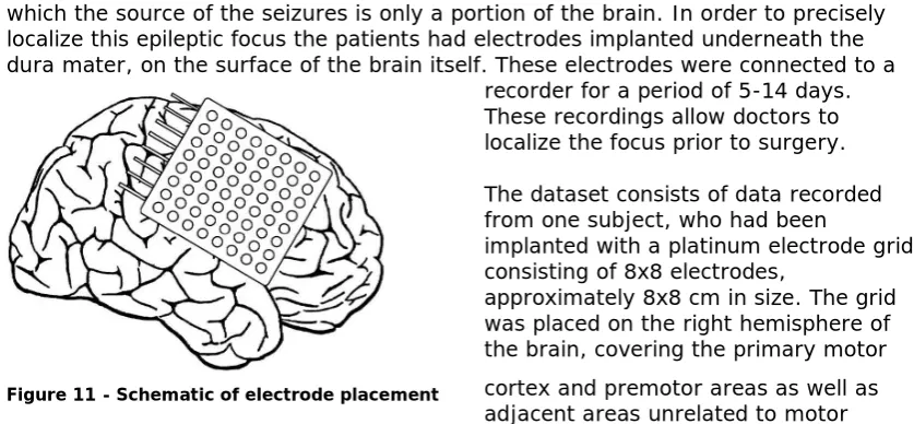 Figure 11 - Schematic of electrode placement