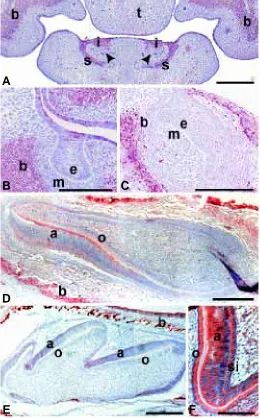 Fig. 2. Immunohistochemical staining for ARNT in different stages of