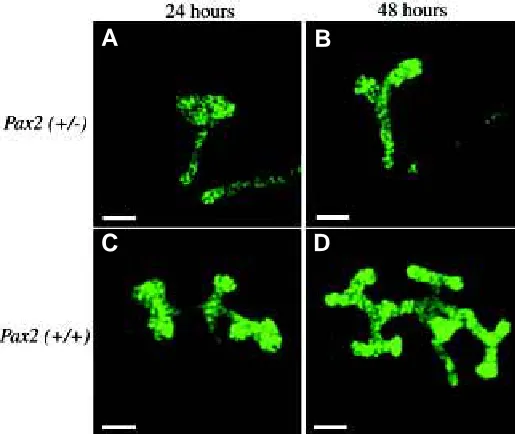 Fig. 4. Green Fluorescent Protein expression in Pax21Neufor 48 hrs. Fewer ureteric buds and less development is seen in theand C were cultured for 24 hrs, while the kidneys in B and D were culturedcent Protein in HoxB7-GFP/wild type (Pax2+/+) kidneys
