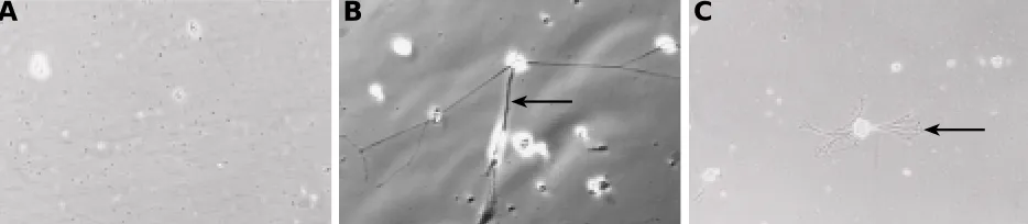Fig. 1. Production of recombinant N-terminal hSlit2 protein. (A) Western blot analysis of progressive steps involved in purification of 140 kDa hSlit2.A monoclonal anti-myc epitope antibody was used to detect the recombinant protein