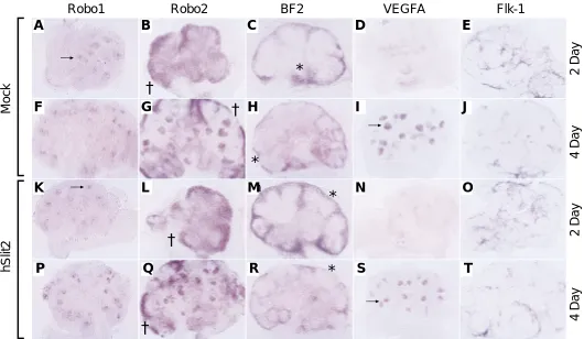 Fig. 3. In situ analysis of hSlit2 treated kidney explants. 2 day (A-E, K-O) and 4 day (F-J, P-T) kidney explants grown with mock-transfected media (A-marker BF2 (* in C,H,M,R) in hSlit2 treated explants is consistently similar to explants grown with the m