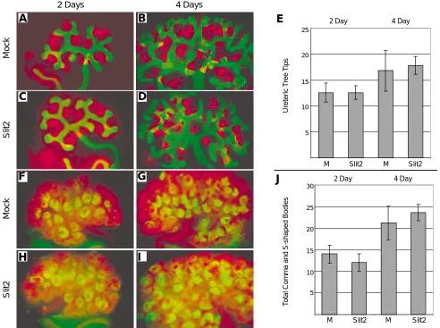 Fig. 4. Expression of markers of kidney development in hSlit2 treated explants. Expression of the ureteric tree marker calbindin 28K (green, A-D),control explants and those grown with 1 cultures
