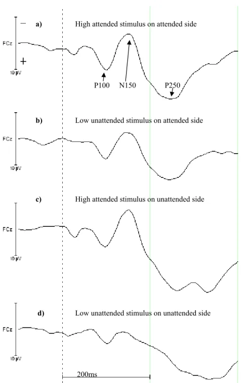 Figure 4.  The four waveforms from the FCz electrode show the EEG for the high intensity to respond to.