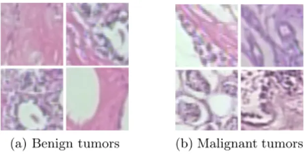 Fig. 1. 64x64 pixel sample patch images used for training the neural networks. They have been generated from random images which belong to the BreakHis dataset