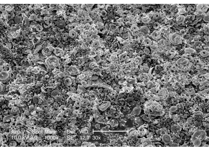 Fig. 4. Scanning electron microscope (SEM) photograph of bulk sediment from sample 590B-30X4, 74^78 cm