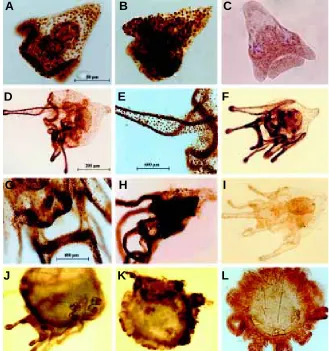 TABLE 1ganglia regions respectively (Fig. 3 E,G). In addition, more exten-sive apoptotic areas were observed in induced plutei and larvaeAPOPTOTIC CELL FREQUENCY IN CELLS DISSOCIATED FROM(Fig