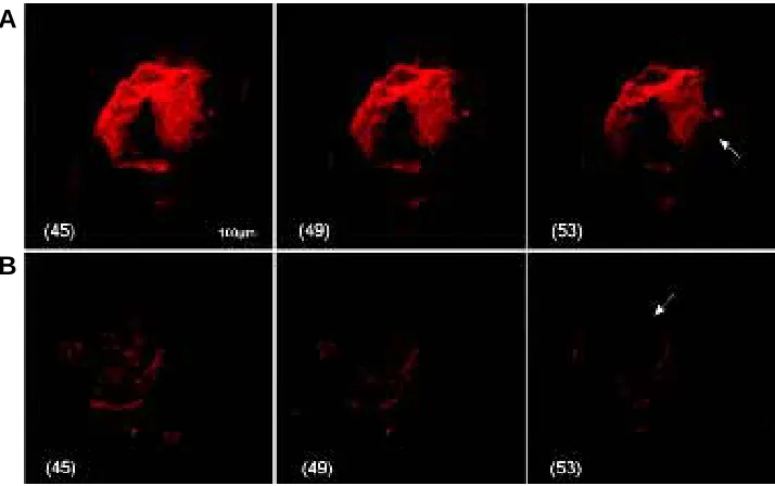 Fig. 4. Whole mounts of larvae observed by confocal laser microscopy after TdT assay. Threea competent larva with big rudiment optical serial sections (45-49-53, of the 107 total sections) of an 8-arms larva with small rudiment (A) and(B)