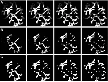 Fig. 1. Binarisation of confocal images. correct depth ‘maximum’ images by selecting those X,Y points which are at their maximal intensity and therefore at theFour consecutive grey level images (A) are first converted to(B)