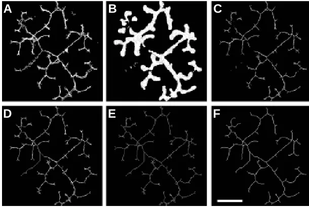 Fig. 2. Skeletonisation procedure. selecting points centred in both the X and Y directions centred in X,Y and those centred in Z are then selected segments by path of minimum distance within the tree limit fixed by the user of all frames for a kidney cultu