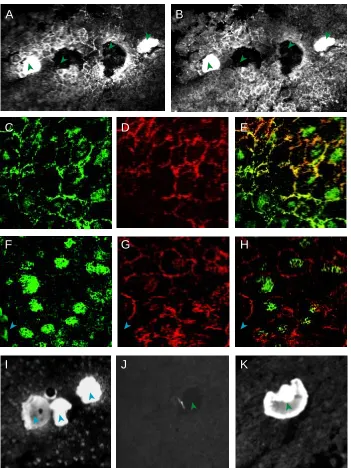Fig. 1. Double immunofluorescence staining forTGF-previously injected with 4 ng of TGF-spaces (see text)]