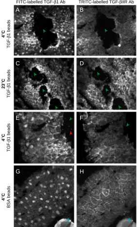 Fig. 4D shows the localization of TGF-βIIR in the sectionanalysed in 4C). A similar result was observed in 4 othersamples