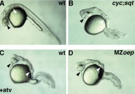 Fig. 1. Phenotypes of  embryo upon overexpression of antivin/lefty1 and mutant at 30 hours post-fertilization