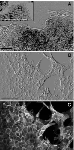 Fig. 6. Effect of bFGF on explanted RPEt colonies. Differential interfer-