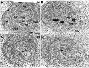 Fig. 2. and parasagittal ED15 in the EK area. The EK at ED15 is less(EK) area at ED14