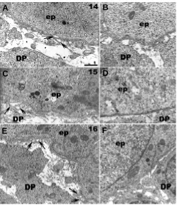 Fig. 4. Transmission electron micrographs of the lower incisor atED14.dental epithelium (IDE) and of the shows the position of the nuclei of the EK epithelial cells distantsame region shows that these granules correspond to mitochondriae