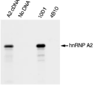 Fig. 6. Immunoblot analysis of proteins crosslinked to poly(A)+in vivo. poly(A)were released from the crosslinked complexes with RNase digestion,resolved by SDS-PAGE, and probed with the indicated antibodies