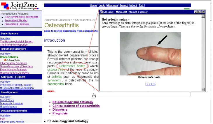 Figure 4: An example of a glossary (referential) link in JointZone  