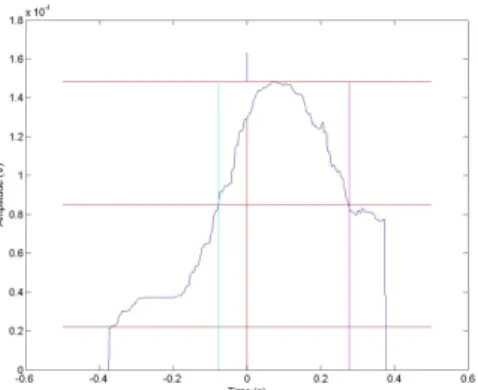 Figure 1. An example of peak 1, where a peak is observed during the time period -0.1 – 0.25 s  after IC  