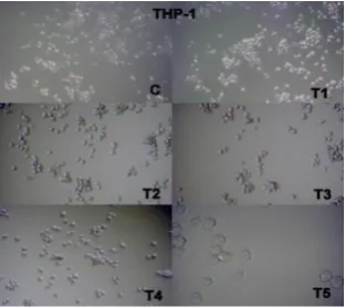 Figure 4. Cell viability and treatment of ethanolic leaf extract of B. lupulina on THP-1 cell line; 