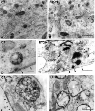 Fig. 4. Electron microscopy of the cell compartments participating in the endocytosisof CF by control (CT) and ethanol-exposed (ETOH) astrocytes