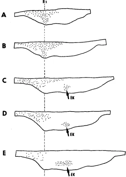 Fig. 4. The 3D reconstruction (A) shows the shape of the dentalepithelium at ED 15.0 (wtc