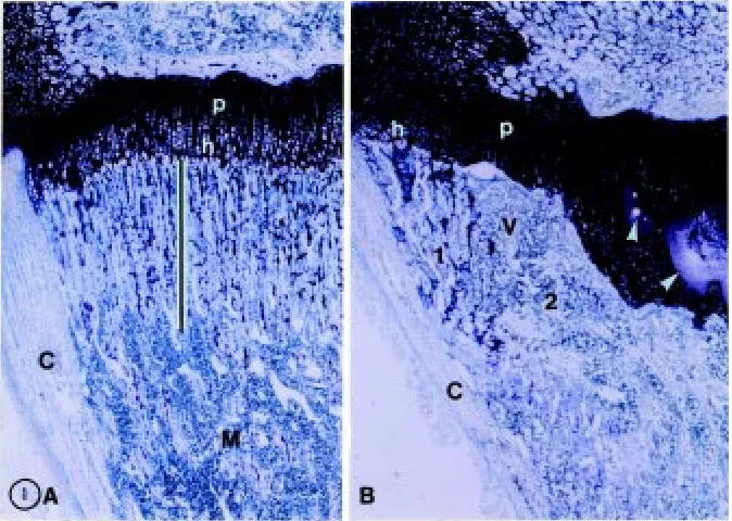 Fig. 1. Representative photomicrographs of theproximal tibia from 4-week-old normal (A) andward the top of each figure and zones of proliferating(p) and hypertrophied (h) chondrocytes are indicated.In normal rats the growth plate cartilage is linear andof 