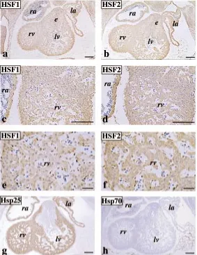 Fig. 2. Immunolocalization of HSF1, HSF2, Hsp25 and Hsp70 in the develop- h); 10 µm (HSF1, chambers, respectively, (e) indicates endocardial cushion tissue.d(g) Hsp25 and andmicrographs of horizontal sections through embryonic hearts